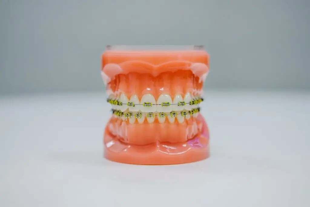 Invisalign במודיעין