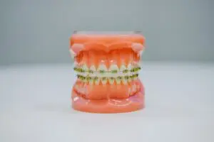 Invisalign במודיעין